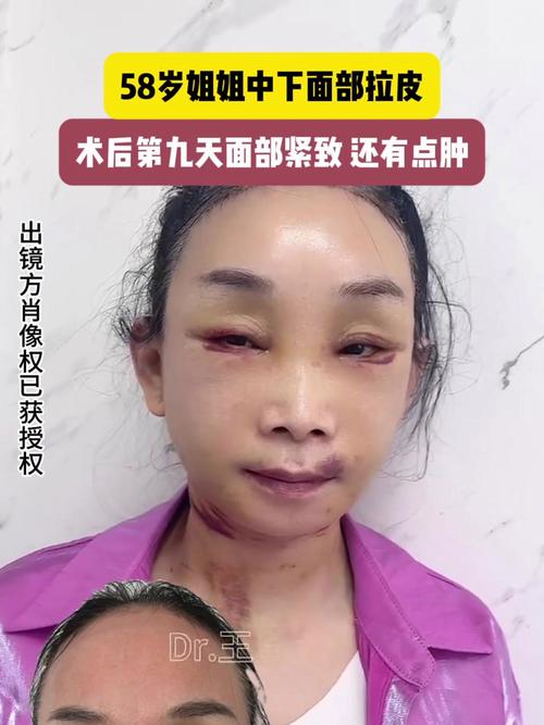 认亲后发现姐姐被卖，姐姐认贼作父