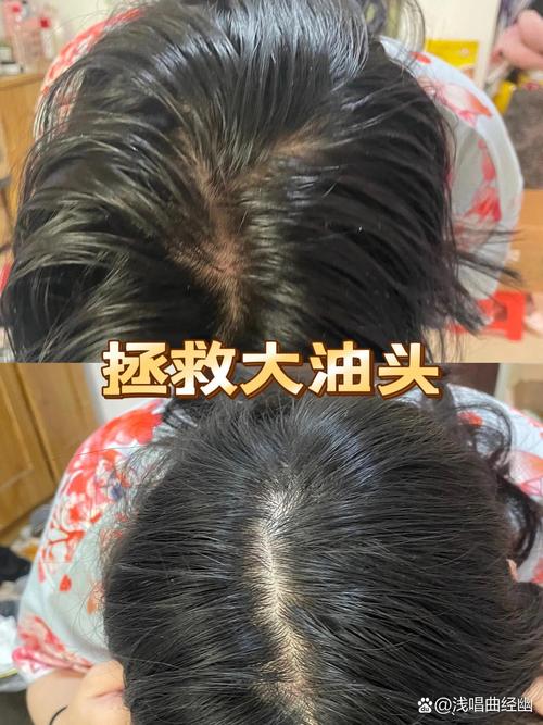 建议头发不要洗太勤，头发是不是不能洗太勤